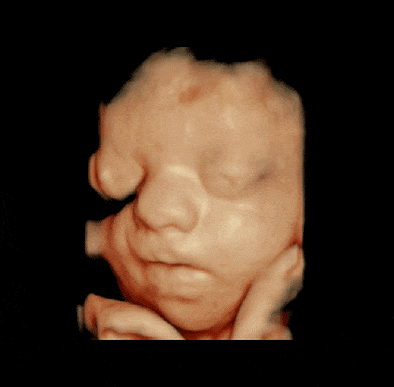 Ultrasonido estructural: ¿Qué es y por qué hacerlo?